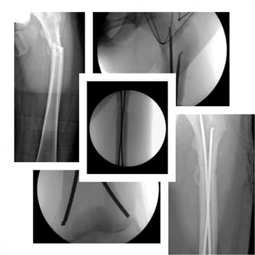 Slider image (4) Dr. Rodrigo Aguirre Rojas Orthopedic Surgeon in Mexico